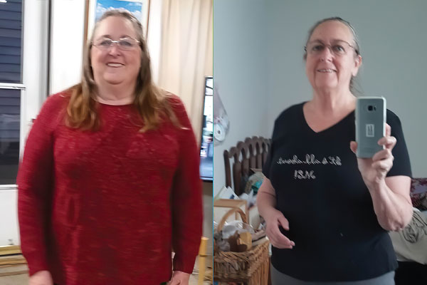 Vickie Maher, pictured before and after bariatric surgery, says she feels better mentally than she has in decades.